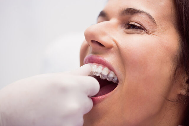 dentist assisting feemale patient wear braces