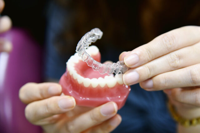 inivisalign bracwsses aligner dentist advice how invisible orthodontics make beautiful teeth dental clinic