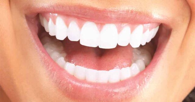 porselen lamina tedavisi konya, konya diş kliniği