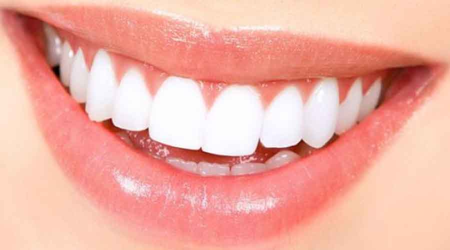 Zirkonyum Diş Tedavisi Süreci Nasıl İlerler ?