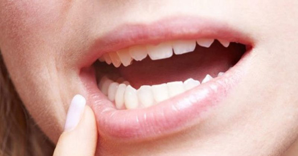 Apseli Dişler ve Tedavi Yöntemleri